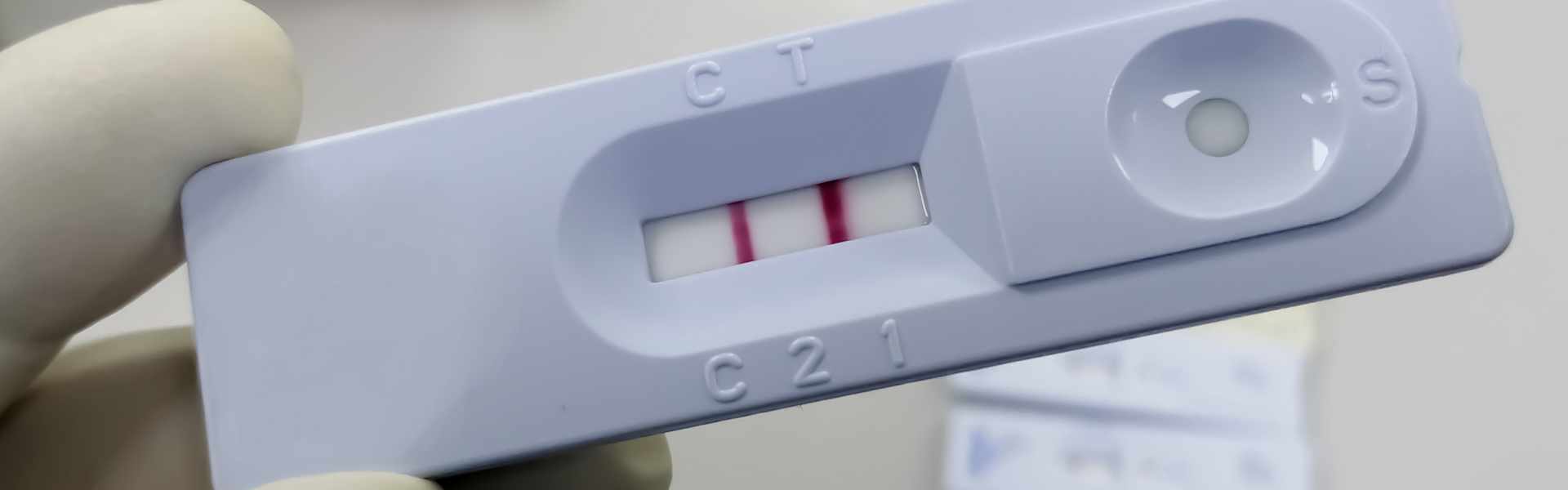 Assay Development Rapid Test